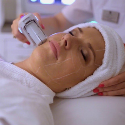 СМАС-лифтинг (SMAS) Альтера (Ultherapy)