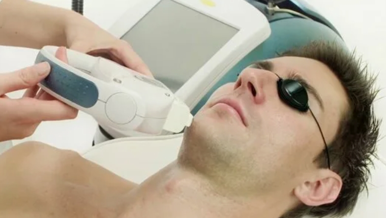 Лазерная эпиляция подбородка  на аппарате Soprano Titanium в Санкт-Петербурге