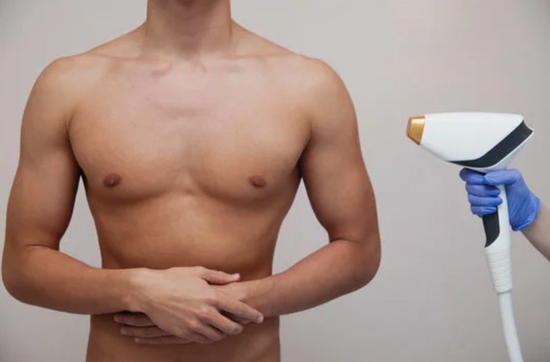 Лазерная эпиляция груди на аппарате Soprano Titanium в Санкт-Петербурге