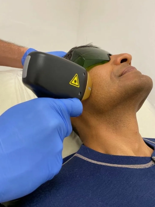 Лазерная эпиляция лица для мужчин на аппарате Сопрано Титаниум